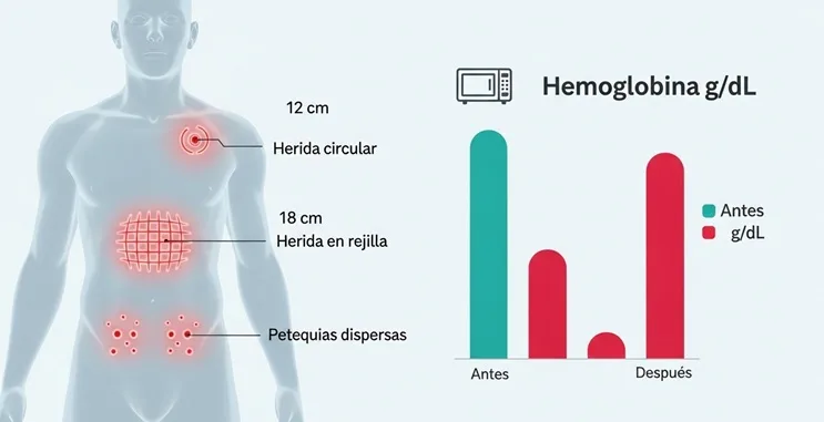 infografía médica que compara hemoglobina y tipos de quemadura provocados por el ovni colares 1977